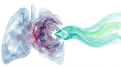 Hyrnuo (Sevabertinib) Nedir? FDA Onayı, Türkiye Ruhsatı ve Geri Ödeme Durumu