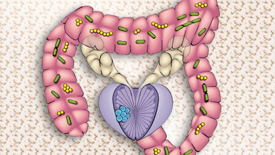 Legătura surprinzătoare dintre microbiota urinei și a prostatei și cancerul de prostată
