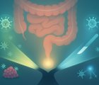 İmmünoterapi Ameliyat Öncesi mi Sonrası mı? dMMR Pozitif Kolon Kanserinde ATOMIC & NICHE-2