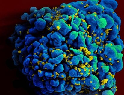 İmmünoterapi ilacı nivolumab, AİDS tedavisi için yeni bir kapı araladı