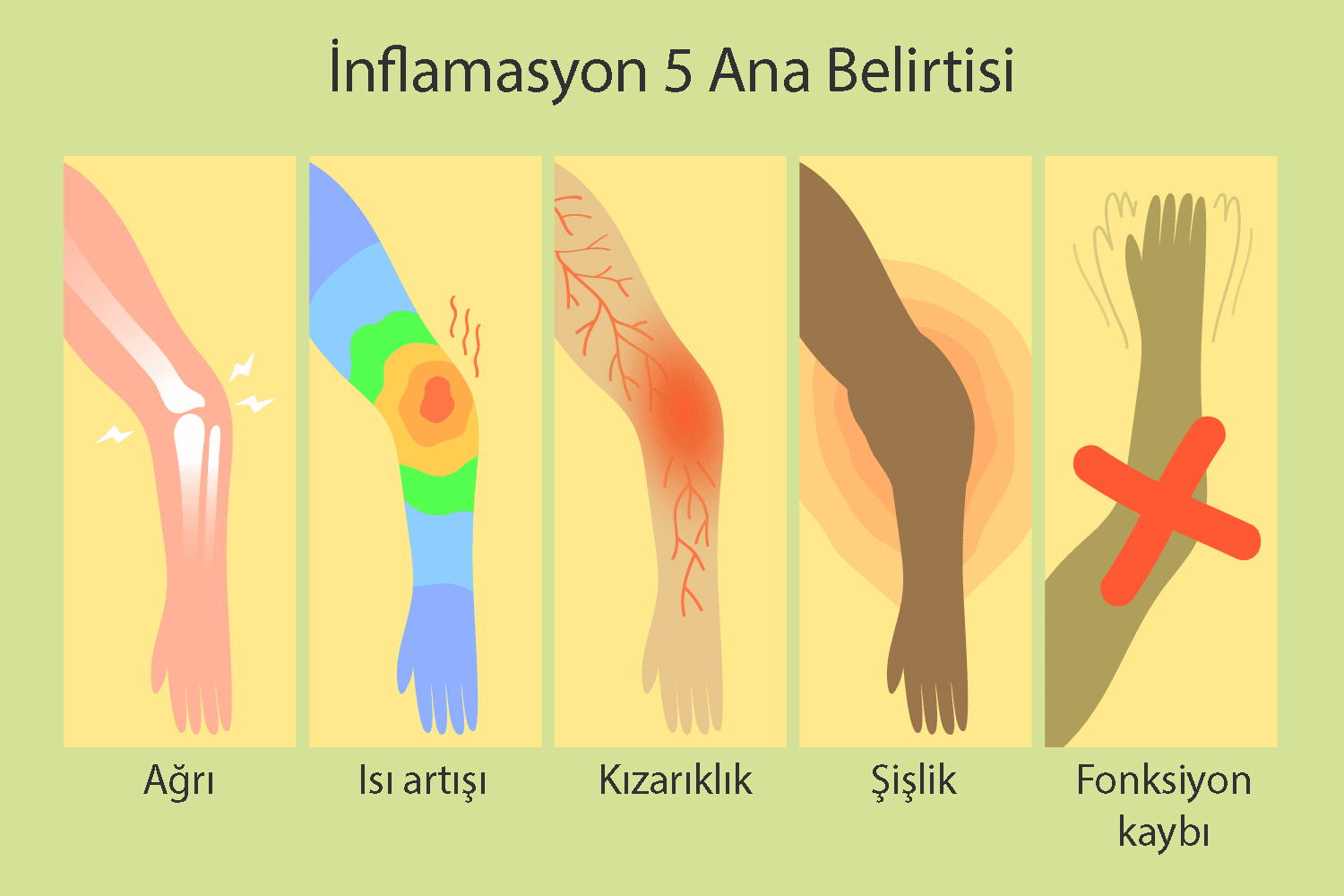 inflamasyonun 5 ana belirtisi nedir 792084
