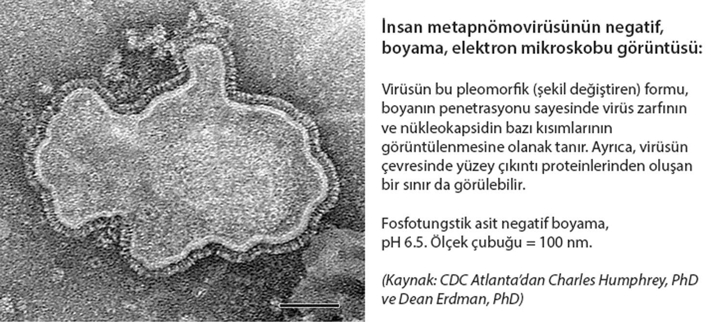 Elektronenmikroskopische Aufnahme des humanen Metapneumovirus mit Negativkontrastierung