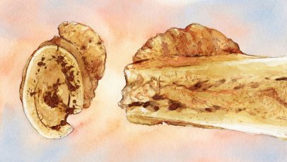 İnsan Soyunda Kaydedilen En Eski Kanser: 1.7 Milyon Yıl