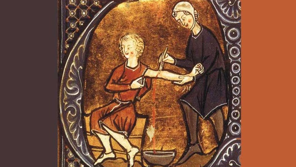 Aderlass (Blutentnahme) 1500 v. Chr. – Ein jahrtausendealtes Missverständnis