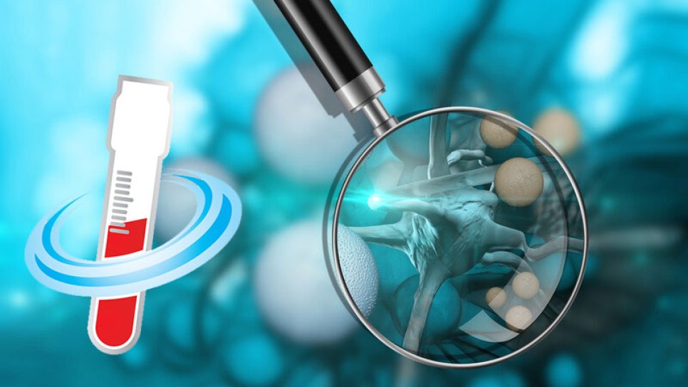 EARLY Cancer Detection with a Blood Test – Too Many False Positives!