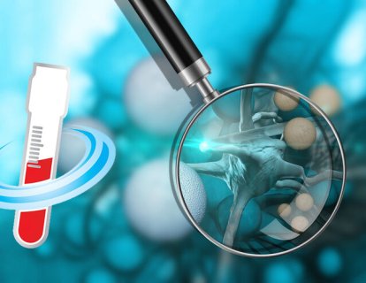 Kan testi ile kanserde ERKEN TANI – çok fazla yanlış pozitif!