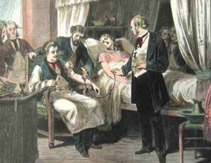 Kan Transfüzyonu 1829 – Kan Kaybına Karşı Mücadele
