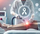 Kanser Hastaları Lazer Epilasyon Yaptırabilir mi? Lazer Kanser Yapar mı?