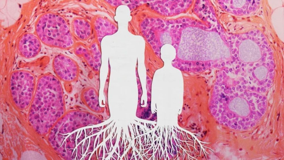 Utilizarea insuficientă a testelor genetice ereditare în cancer – Se pierde o oportunitate?