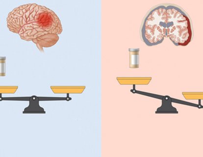 Kanser Hastalarında Kan Sulandırıcı İlaçlar, Arterlerde Pıhtı Oluşum Riskini Azaltmıyor