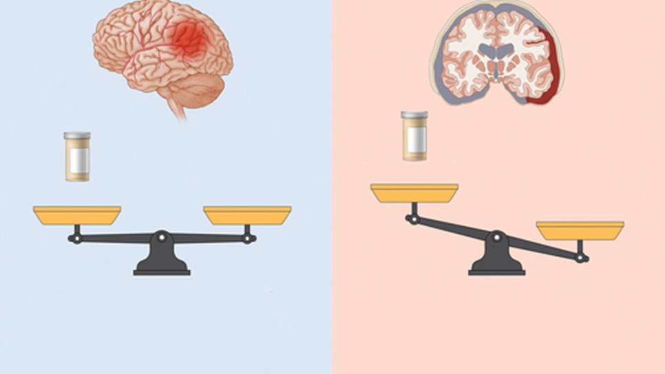 Kanser Hastalarında Kan Sulandırıcı İlaçlar, Arterlerde Pıhtı Oluşum Riskini Azaltmıyor