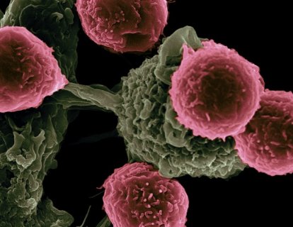 Kanserde önemli 5 gelişme – 2021 AACR Yıllık Toplantısı