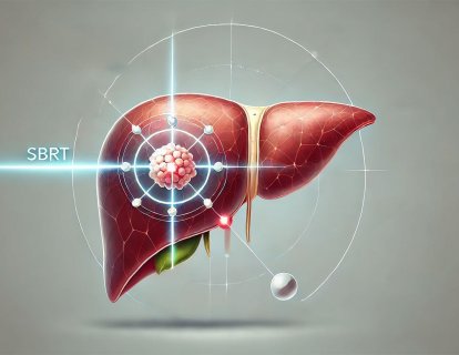 Karaciğer Kanseri Tedavisinde SBRT – Yeni Bir Şampiyon mu Doğuyor?