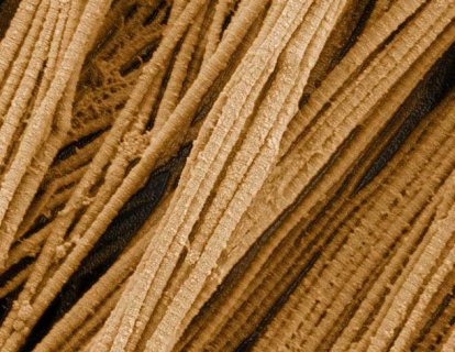 Kollajen nedir, ne işe yarar, neden elde edilir, en çok nelerde var?