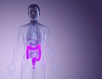 Kolon-rektum kanserinde nüks (tekrar) riskini ve kemoterapi ihtiyacını belirlemek için LİKİT (KANDAN) BİYOPSİ