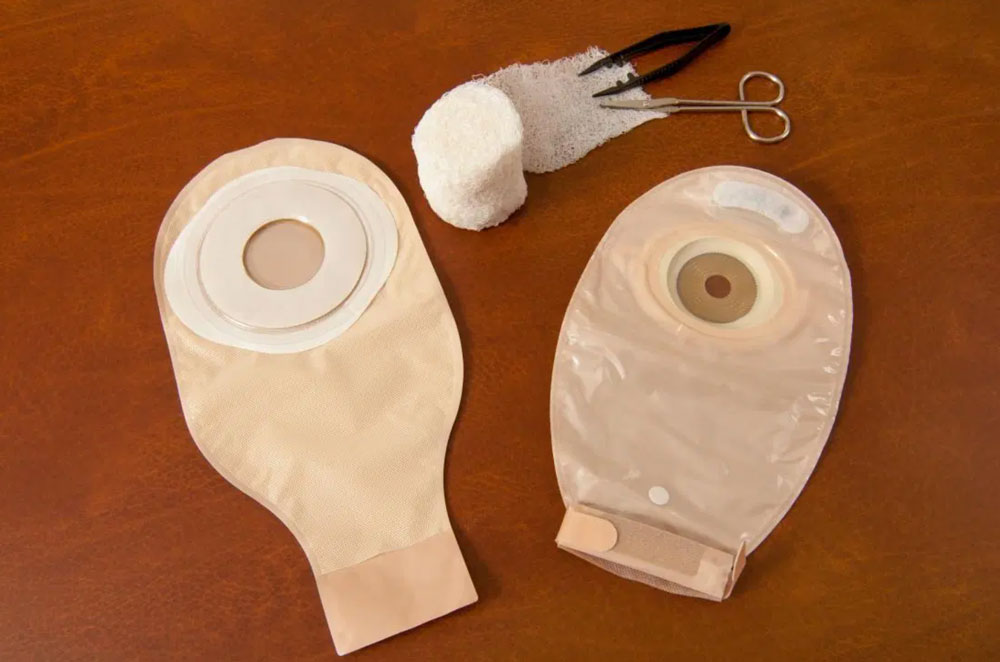 what types of colostomy bag are there