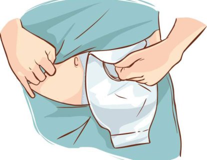Kolostomi Torbası Nedir? Neden Takılır, Nasıl Boşaltılır?