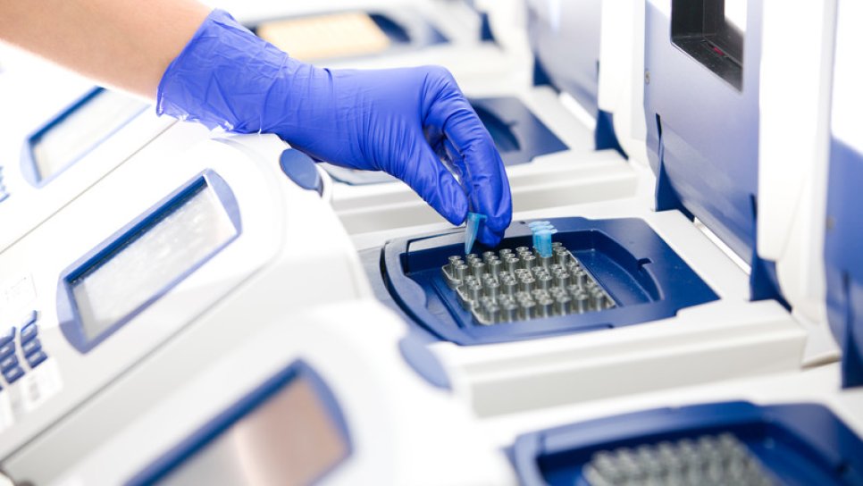Wie wird ein Coronavirus-Test durchgeführt? Welche Arten von PCR- und diagnostischen Schnelltests gibt es?