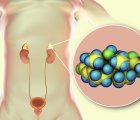 Kortizol ve Kortizon Hormonu Nedir? Ne İşe Yarar?