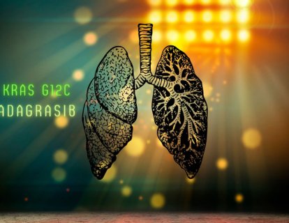 KRAS G12C Mutasyonu Pozitif Akciğer Kanseri için Adagrasib FDA Onayı Aldı