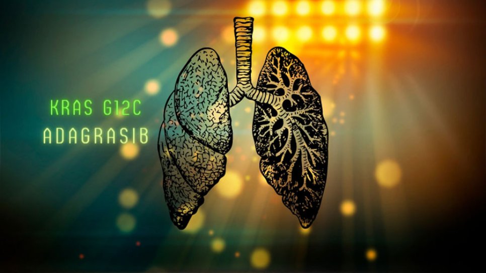 KRAS G12C Mutasyonu Pozitif Akciğer Kanseri için Adagrasib FDA Onayı Aldı