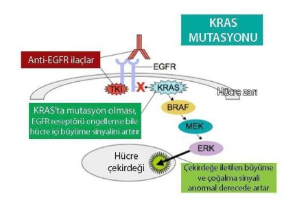 KRAS mutasyonu nedir? Kolon ve diğer kanserlerde KRAS pozitifliği