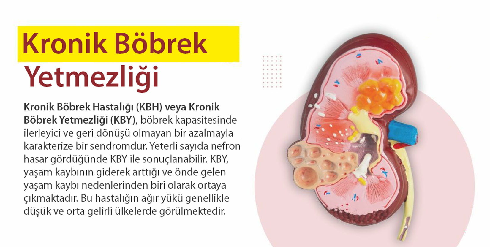 xroniki böyrək xəstəliyi nədir