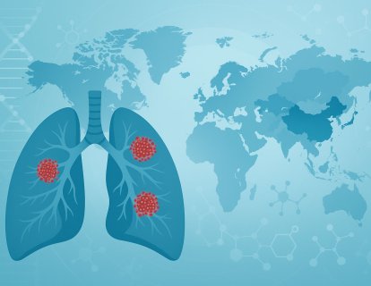 Küçük Hücreli Akciğer Kanseri İkinci Basamak Tedavisi Yeniden Yazılıyor