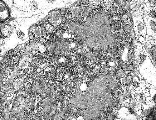 Tollwut Rabies-Virus