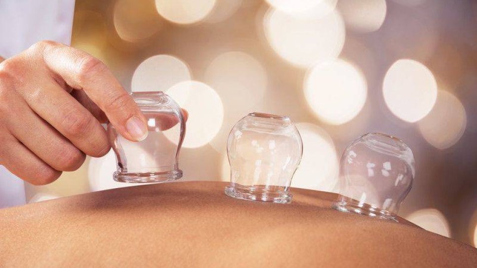 Kupa (Bardak Çekme) Terapisi Nedir? Kullanım Alanları, Faydaları ve Riskleri