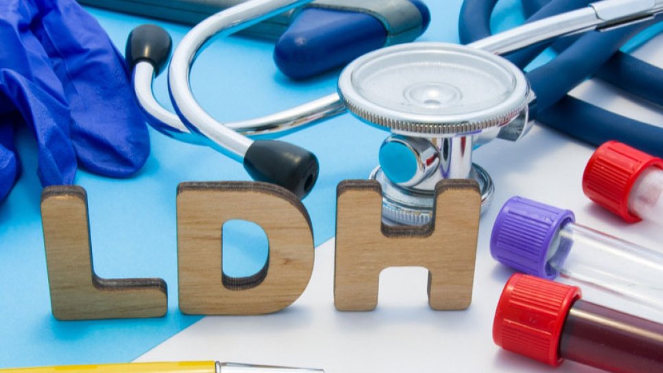 LDH Nedir? Kanser Hastalarında LDH Yüksekliği