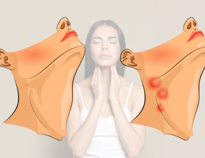 Lenfadenit Nedir? Belirtileri Nelerdir? Kanser midir?