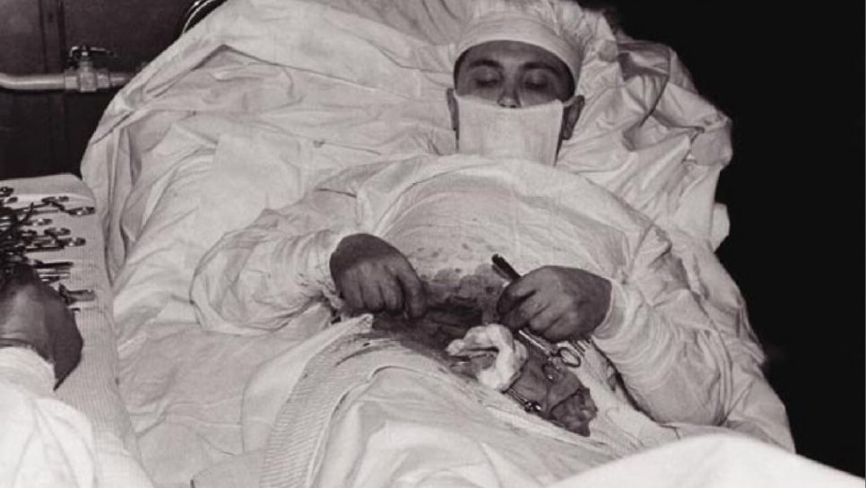 Operating on Oneself 1961 – Heroic Doctors