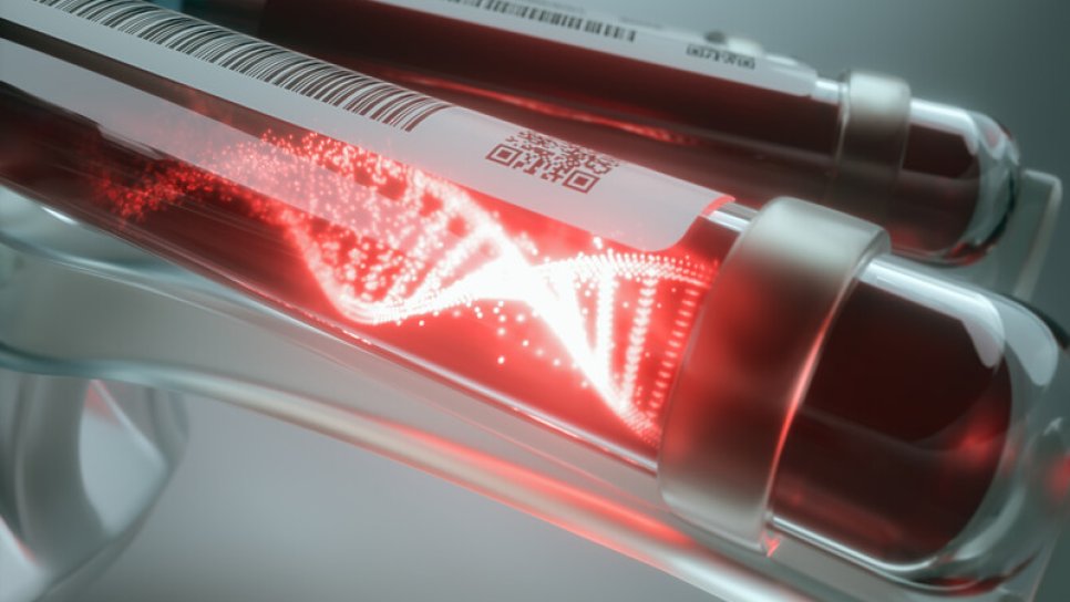 Der Tumormutationslast-Test aus Blut sagt das Ansprechen auf Immuntherapie bei Lungenkrebs im Stadium 4 voraus