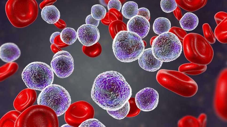 What is leukemia and what are its types? What are overall survival rates by age?