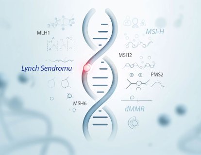 Lynch Sendromlu Kişilerin Yaşam Süreleri, Genel Toplumla Benzer mi?