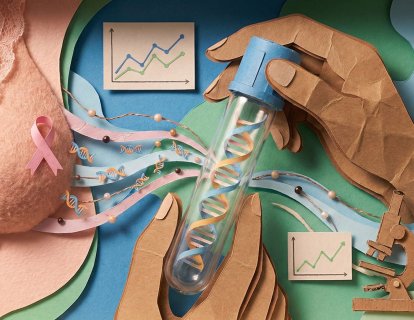 Metastatik Meme Kanserinde ctDNA Kan Testi ile Tedaviyi Azaltmak