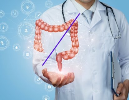 Metastatik RAS-Wild Sol Kolorektal Kanserde Panitumumab Bevasizumabdan Üstün