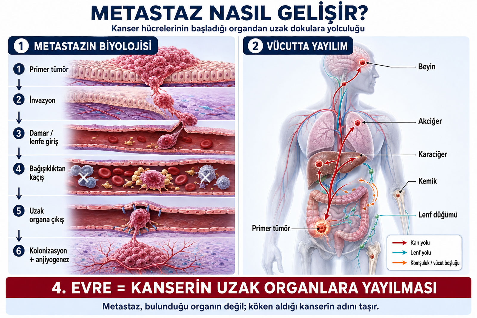 metastaz nedir ve nasil gelisir prof dr mustafa ozdogan 847322