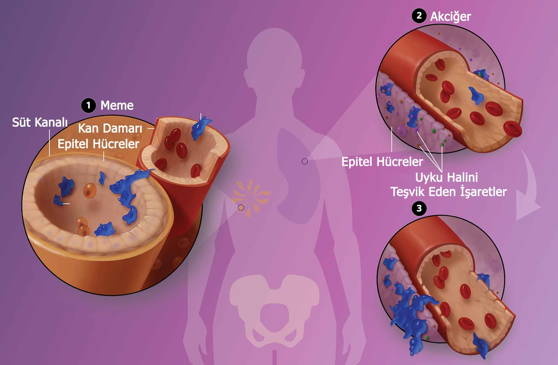 metastaza yeni bir bakis 922718