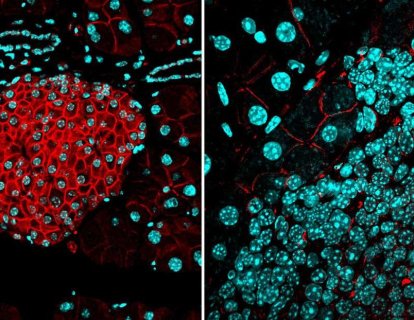 Metastazı Durduran Biyolojik Bir Bariyer Keşfedildi