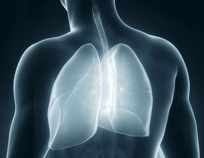 Plevral mezotelyoma (akciğer zarı kanseri) tedavisinde elektriksel akım tedavisi FDA onayı aldı