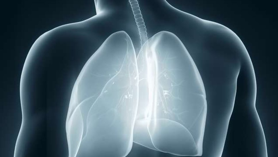 Plevral mezotelyoma (akciğer zarı kanseri) tedavisinde elektriksel akım tedavisi FDA onayı aldı