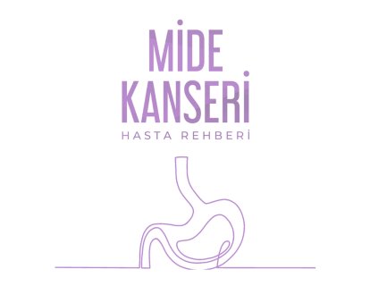 Mide Kanseri Belirtileri, Evreleri ve Tedavisi – Hasta Rehberi