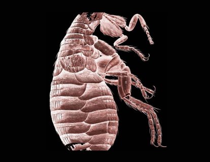 Mikrografi 1665 – Robert Hooke mikroskop ile dünya tarihine iz bırakıyor