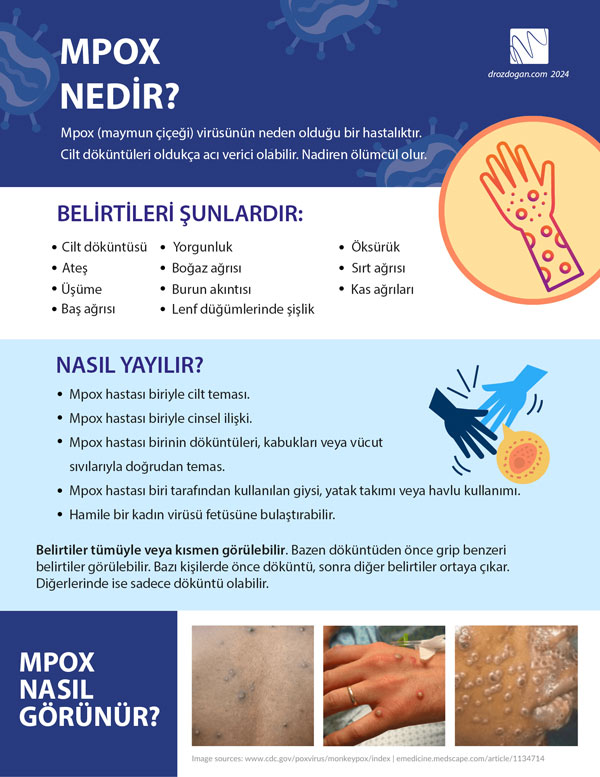 اینفوگرافیک و پوستر: Mpox چیست و چگونه منتشر میشود