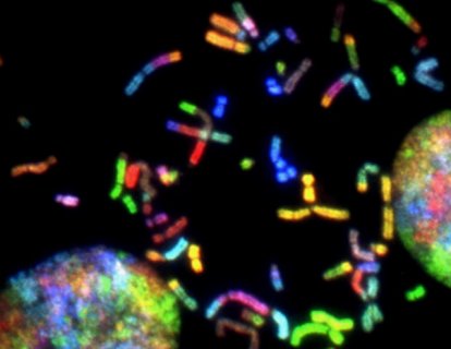 MSH2 mutasyonu nedir? Bilmeniz gerekenler