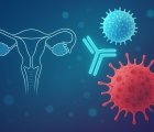 Nadir ve Agresif Jinekolojik Tümörlerde Nivolumab ve İpilimumab Kombinasyonu