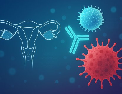 Nadir ve Agresif Jinekolojik Tümörlerde Nivolumab ve İpilimumab Kombinasyonu