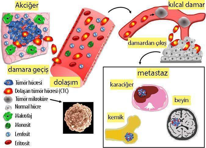 nature Kucuk hucreli akciger kanserinde tedavi direncinin sebebi tumor kurecikleri 423305